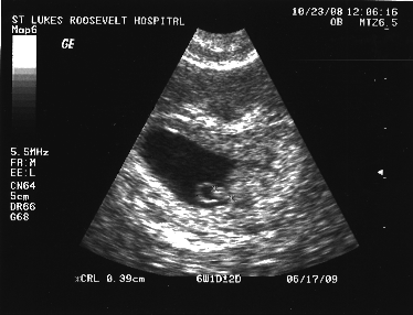 Ultrasound 2008-10-23