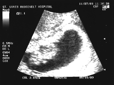 Ultrasound 2008-11-07