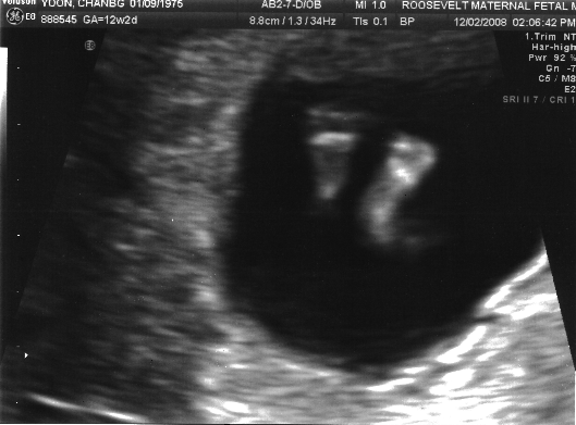 ultrasound_20081202_feet